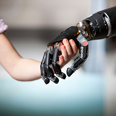 HDTProsArm_3 Bionic Prosthetic Arm