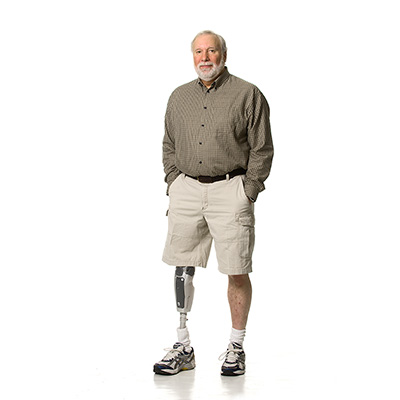 Bionic Prosthetic Knee